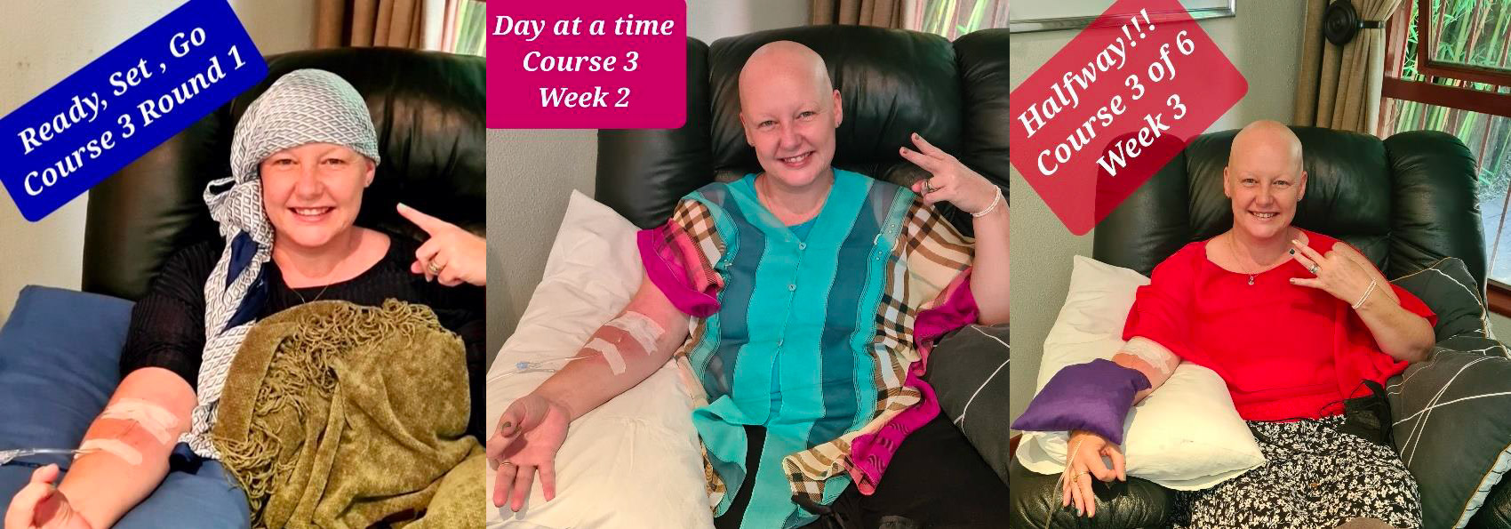 Chemotherapy Course 3 – February 2022
